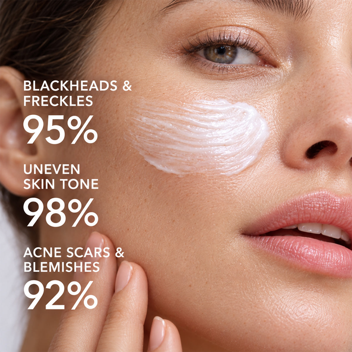 Highly effective whitening and spot-lightening cream