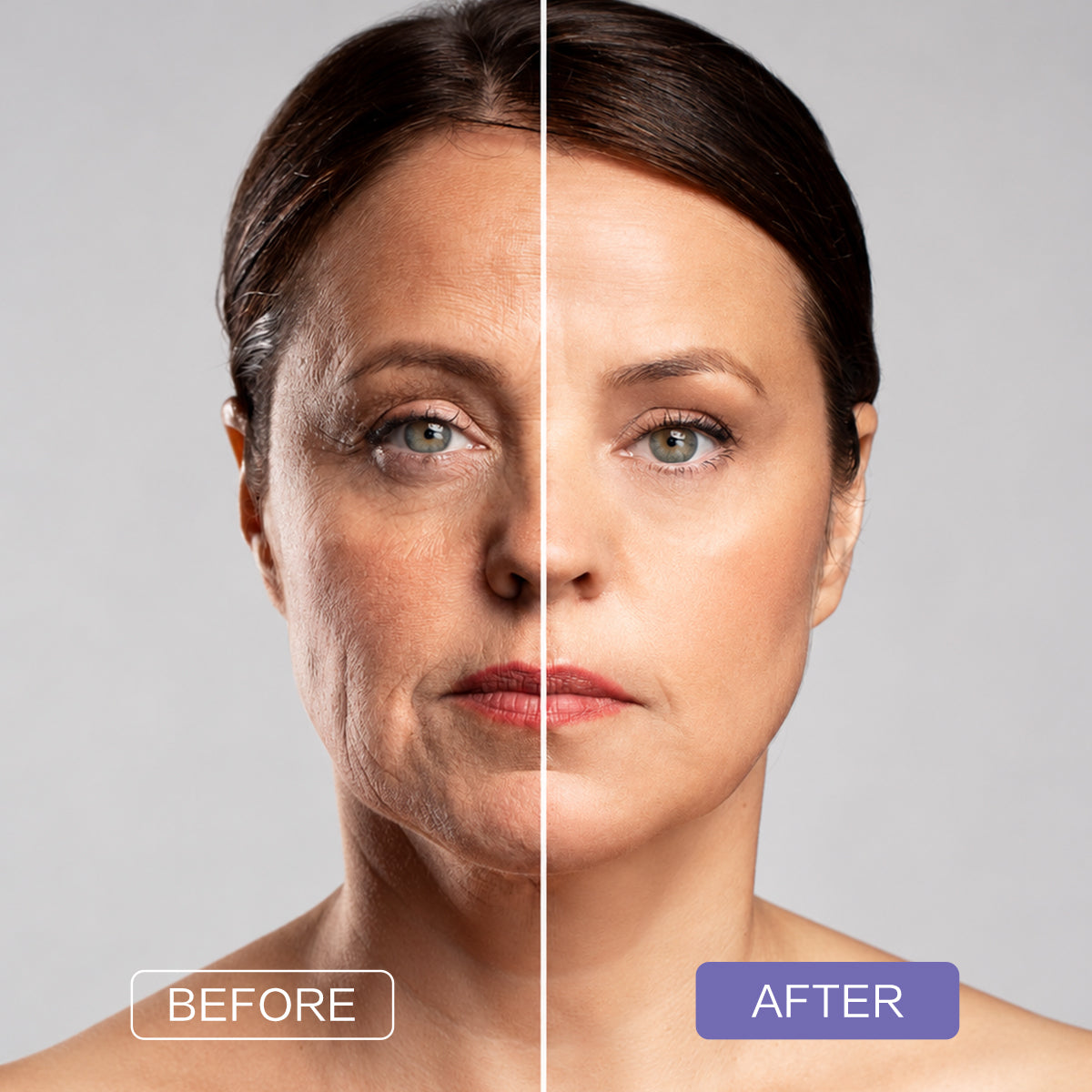 Advanced Collagen V-Roller Neck Cream
