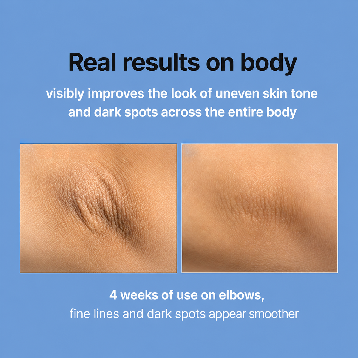 Retinal Skin Booster Serum