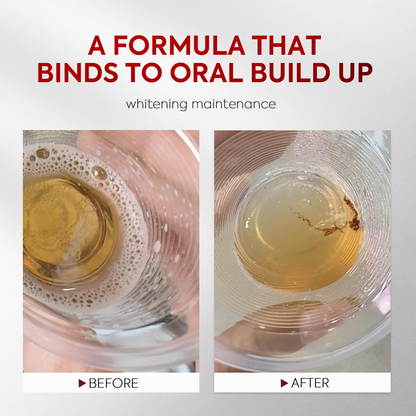 Advanced Stain-Lifting Whitening Mouthwash
