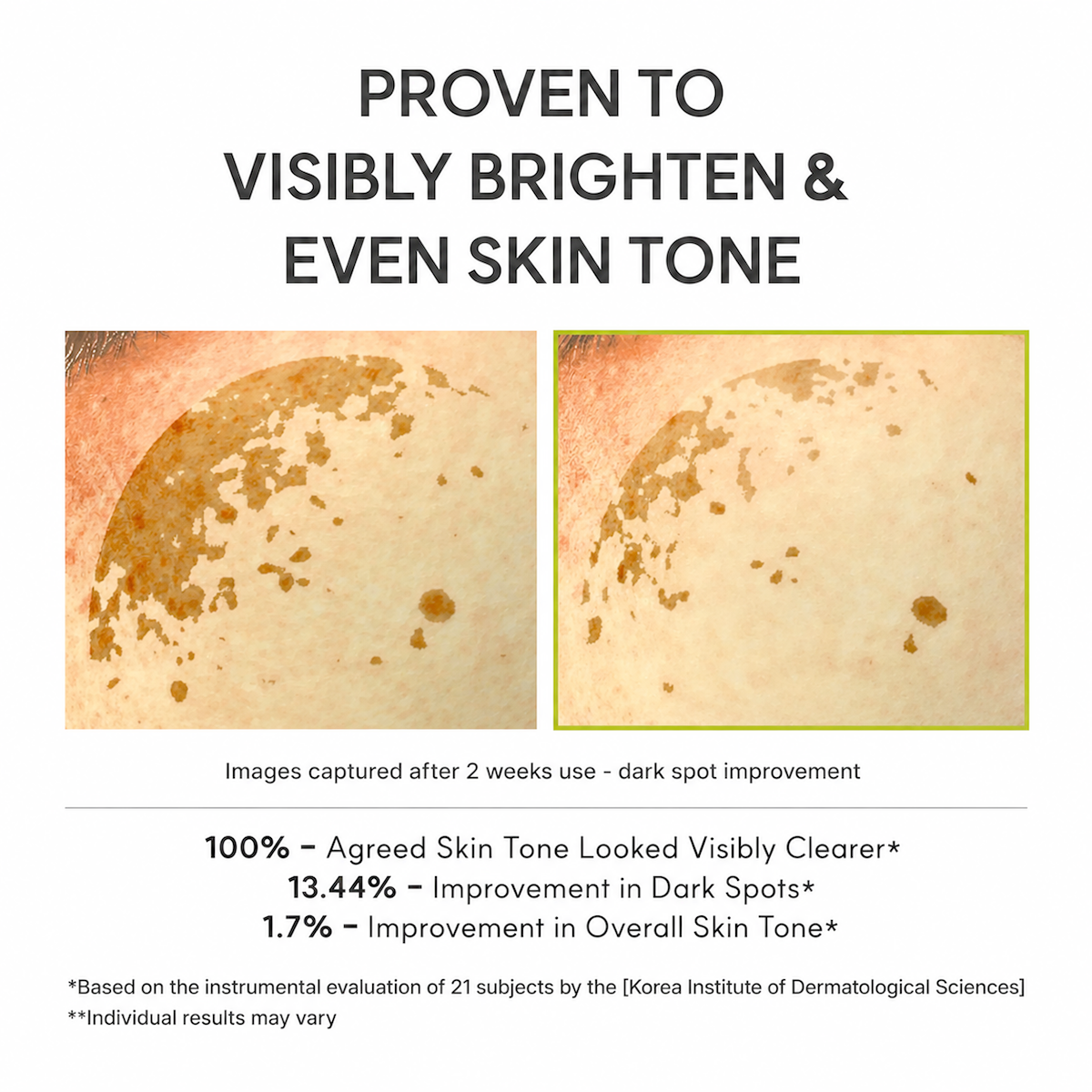 Vitamin C Glutathione Booster Shot Skin Serum