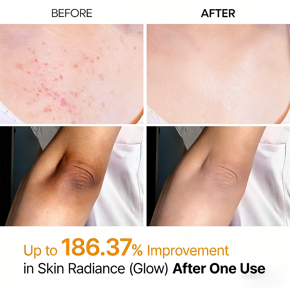 🌸 New! Peeling Shot Keratin Care Kojic Acid Turmeric Spray