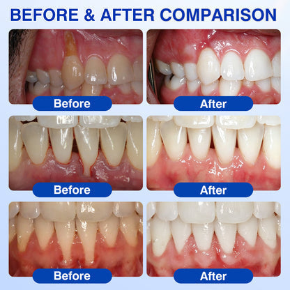 Periodontal Repair Gel
